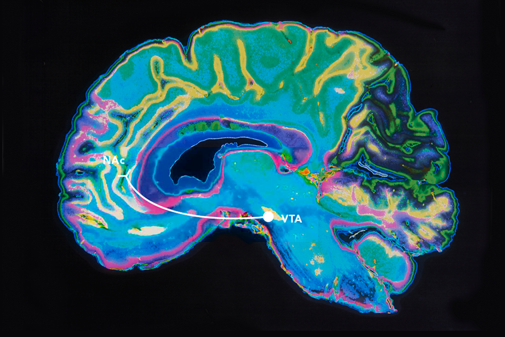 les mécanismes de l'addiction révélés