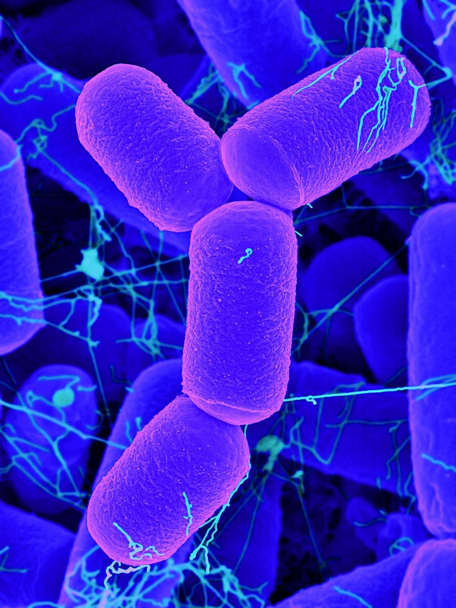 Methanobrevibacter oralis
