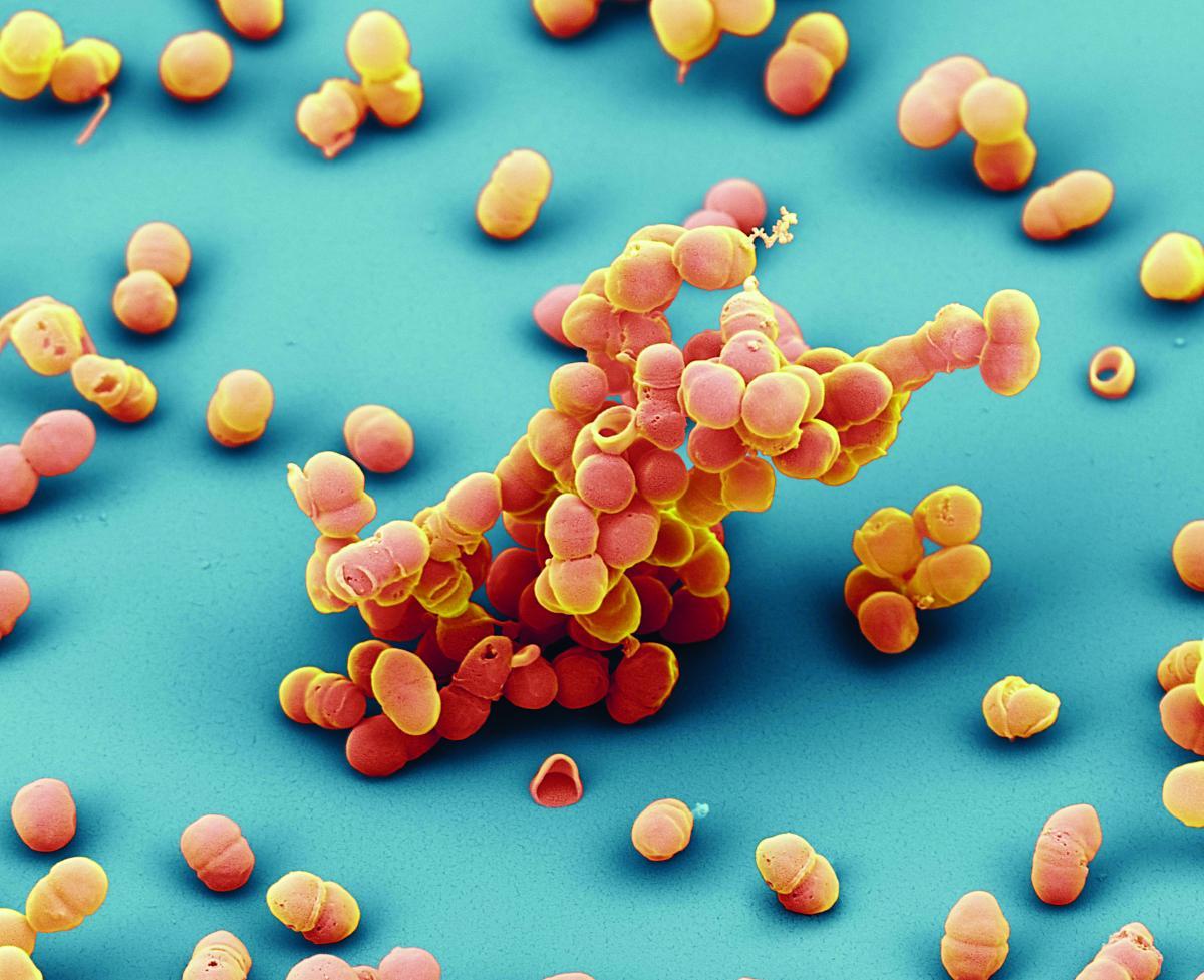 Staphylococcus epidermidis