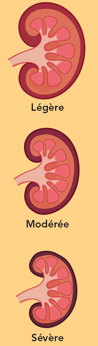  une maladie évolutive grave