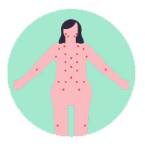 Ganglion lymphatique