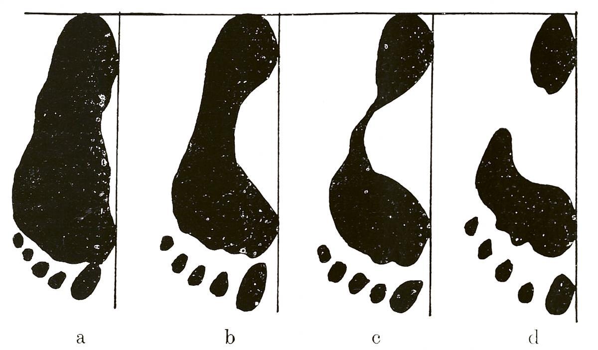 Différents types de pieds