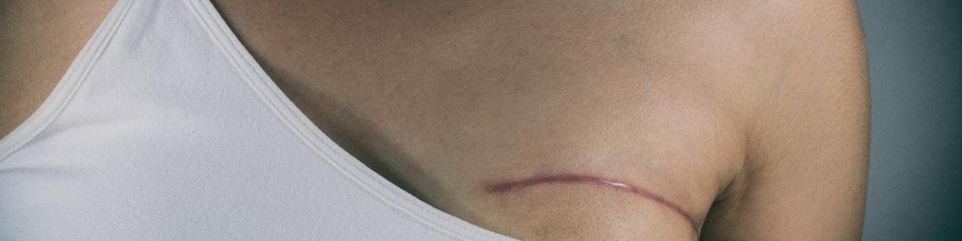 Les HUG et le GHOL s’associent