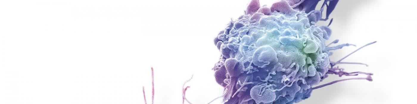 L’oncologie de précision : une nouvelle ère dans la lutte contre le cancer