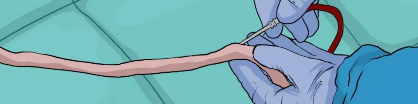 sang fœtoplacentaire