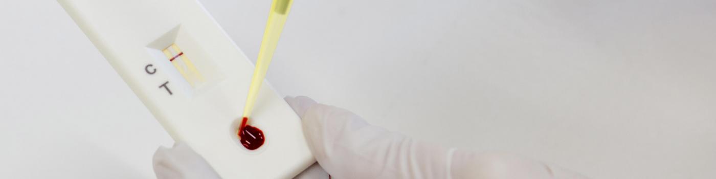 Un marqueur pour éviter un scanner