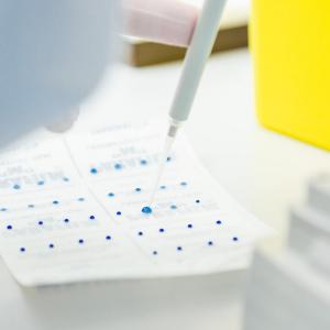 séquençage variant SARS-CoV-2