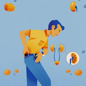 Les calculs rénaux