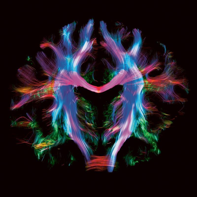 Grâce au fort signal de l'IRM 7T, il est possible de voir les fibres allant d’une région cérébrale à l’autre et se croisant dans certaines sub-régions cérébrales. Grâce au fort signal de l'IRM 7T, il est possible de voir les fibres allant d’une région cérébrale à l’autre et se croisant dans certaines sub-régions cérébrales.