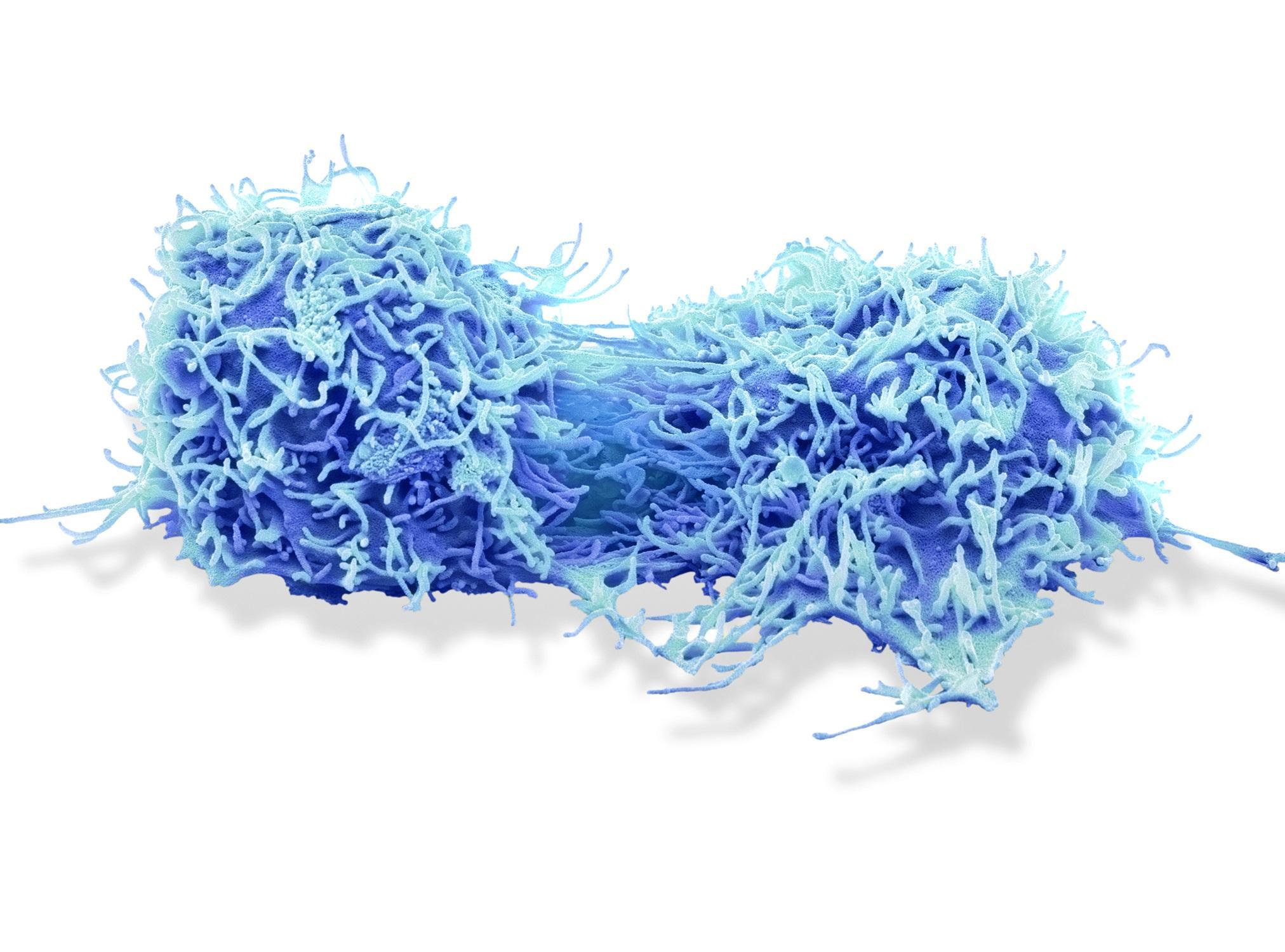 Cellules de cancer du sein cultivées sur une plaque de verre (image grossie 2920x). La surface irrégulière est typique des cellules cancéreuses. Cellules de cancer du sein cultivées sur une plaque de verre (image grossie 2920x). La surface irrégulière est typique des cellules cancéreuses.