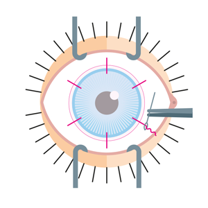 Couture du patch Couture du patch