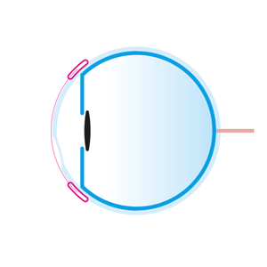 Vue latérale de l’œil Vue latérale de l’œil