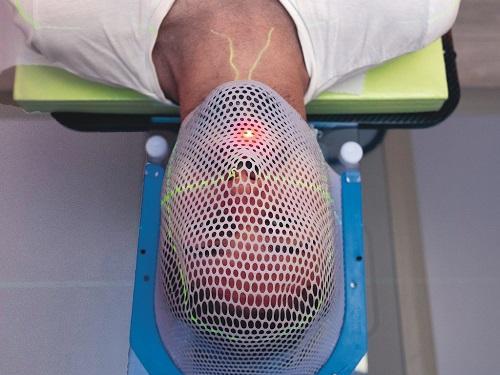 plateau radio-oncologie